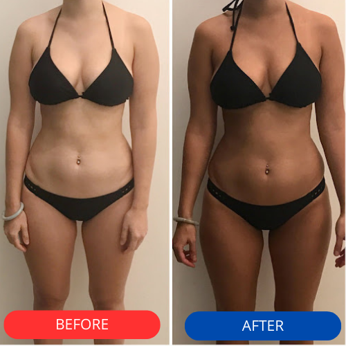 Zolura™ Tanning Gel